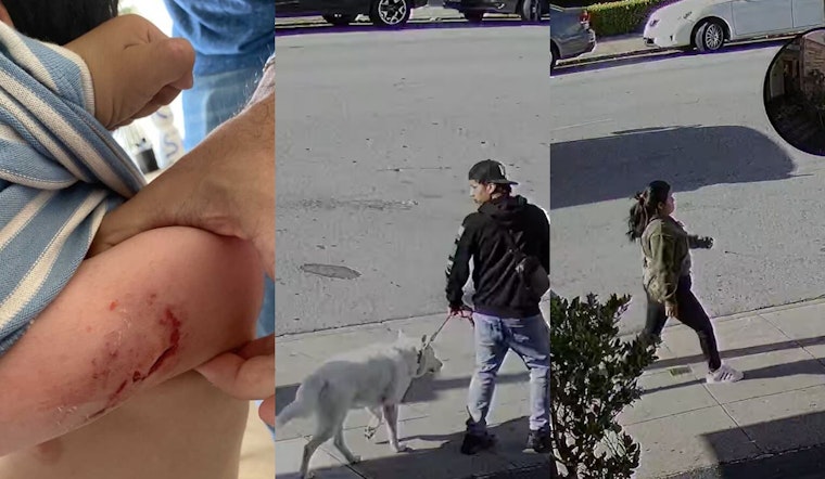 BREAKING VIDEO: Toddler Brutally Injured in Dog Attack near San Francisco Preschool; Dog Owners At-Large