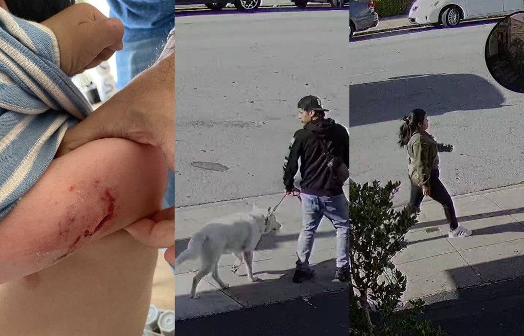 BREAKING VIDEO: Toddler Brutally Injured in Dog Attack near San Francisco Preschool; Dog Owners At-Large