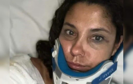 Hit-and-Run Driver in Fort Lauderdale Helps Injured E-Bike Rider Before Fleeing Scene