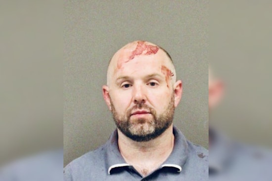 Man Charged with Mayhem After Biting Off Ear in North Plymouth Brawl