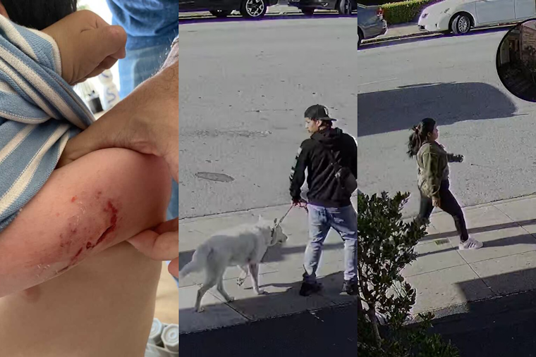 UPDATE: SFPD Identifies Dog Owners from Viral Mauling Video that Showed Vicious Attack on Four-Year-Old Near Marina Preschool