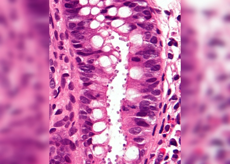 Cryptosporidiosis Outbreak Linked to Rock Island Wildlife Facility