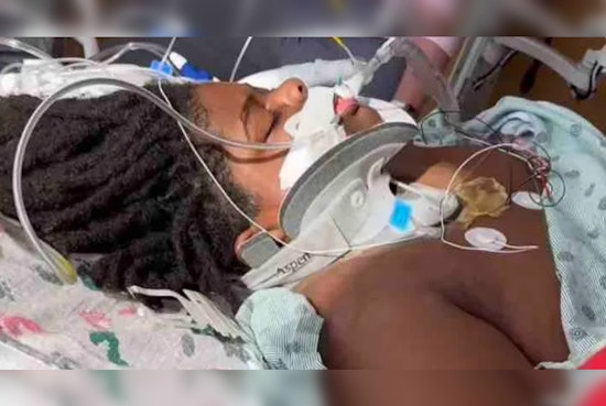 Frisco Teen Paralyzed After Diving Incident in Texas Pool While Escaping Wasp