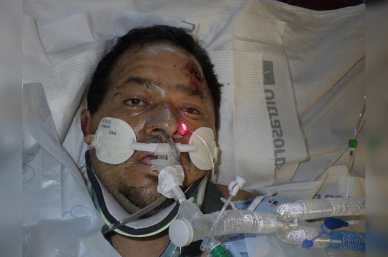 Los Angeles General Medical Hospital Appeals for Help to Identify John Doe Patient Following Accident