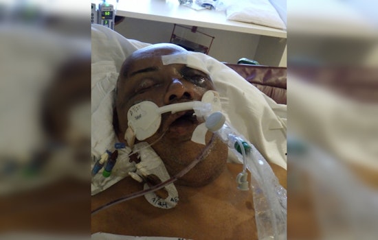 Los Angeles Hospital Seeks Public Help to Identify Mystery Patient Found Near 7th and Kohler