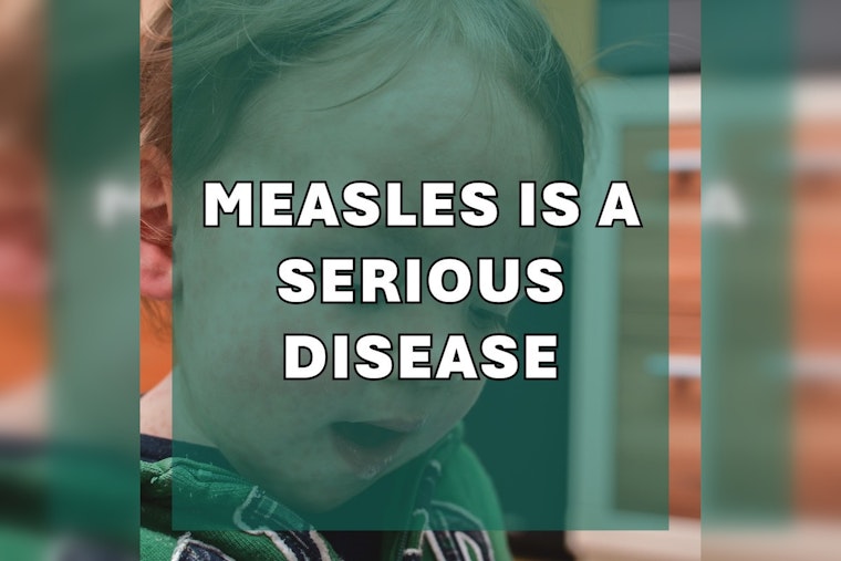 Marion County Hit By Measles Outbreak, Officials Urge Vaccination After Fourth Case Emerges