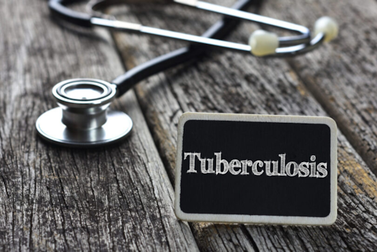 Possible Tuberculosis Exposure at Father Joe’s San Diego Center Prompts Health Investigation