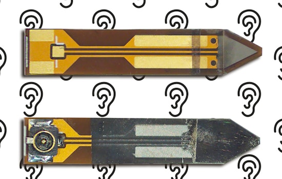 Researchers at MIT and Partner Universities Make Advances Towards Fully Internal Cochlear Implants