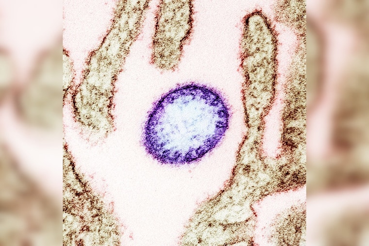 University of Minnesota's CIDRAP Unveils 2024-29 Roadmap for Nipah Virus Countermeasures