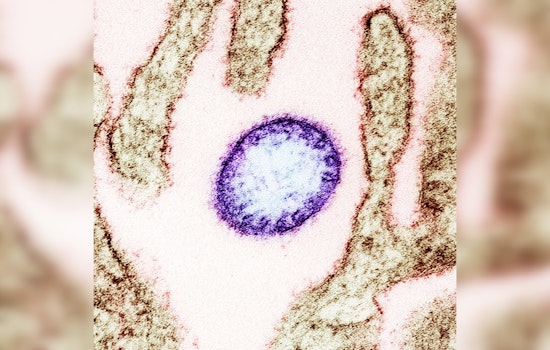 University of Minnesota's CIDRAP Unveils 2024-29 Roadmap for Nipah Virus Countermeasures