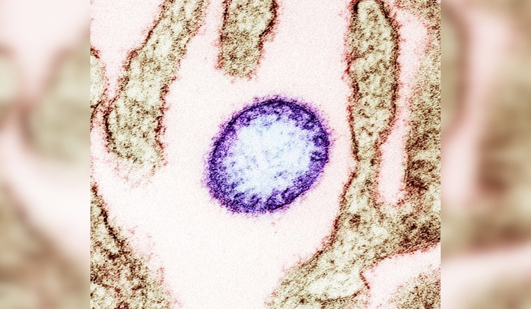 University of Minnesota's CIDRAP Unveils 2024-29 Roadmap for Nipah Virus Countermeasures