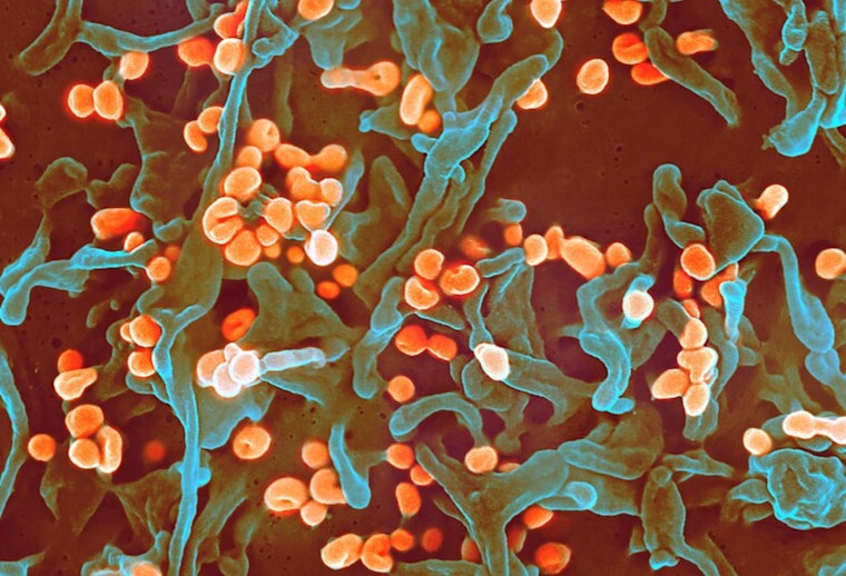 University of Minnesota's CIDRAP Releases R&D Roadmap to Combat Lassa Fever in West Africa