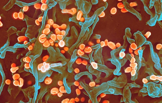 University of Minnesota's CIDRAP Releases R&D Roadmap to Combat Lassa Fever in West Africa