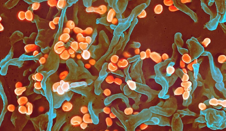 University of Minnesota's CIDRAP Releases R&D Roadmap to Combat Lassa Fever in West Africa