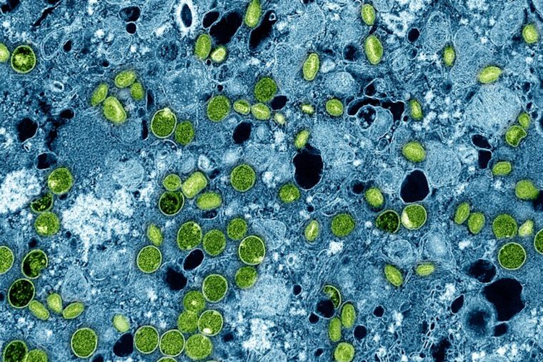 Denver Health Officials Urge Full Vaccination Amid Continued Mpox Circulation