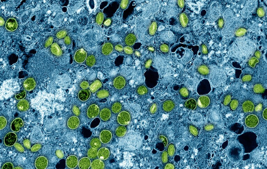Denver Health Officials Urge Full Vaccination Amid Continued Mpox Circulation
