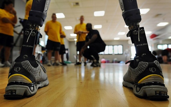 Gaza Bombing Survivor Arrives in Chicago for Prosthetic Limbs and Treatment