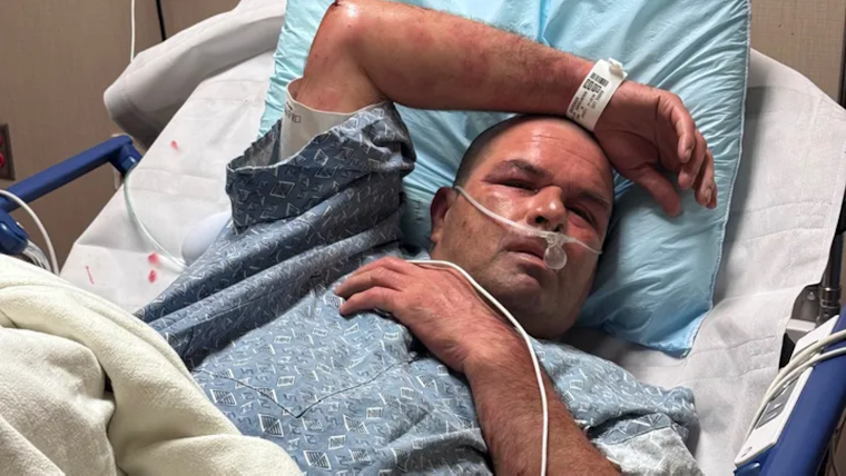 Gilbert Landscaper Survives Near-Fatal Bee Attack with Over 300 Stings, Community Rallies to Support Recovery