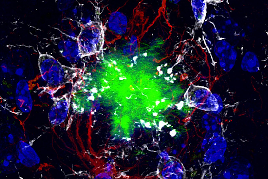 Groundbreaking Alzheimer's Breakthrough, UC San Diego and UPenn Bag $6.9M Grant for Promising New Drug