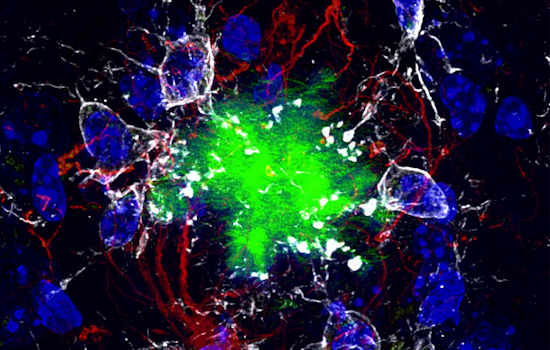 Groundbreaking Alzheimer's Breakthrough, UC San Diego and UPenn Bag $6.9M Grant for Promising New Drug