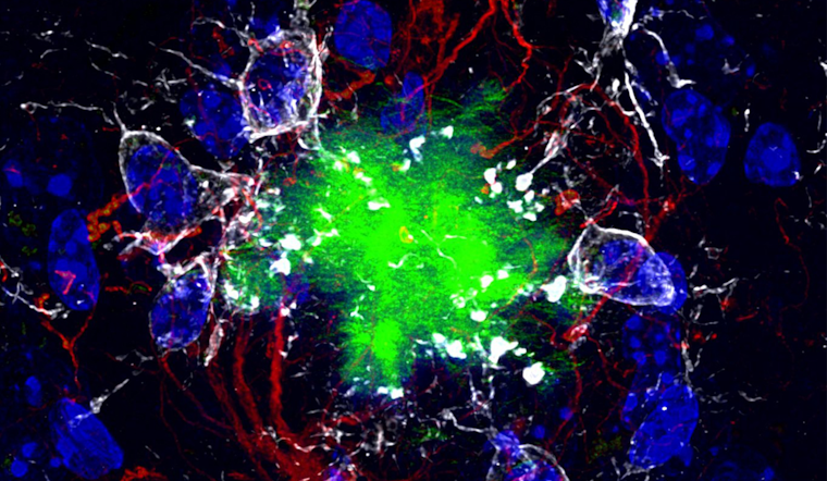 Groundbreaking Alzheimer's Breakthrough, UC San Diego and UPenn Bag $6.9M Grant for Promising New Drug