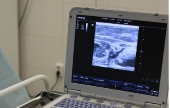 Indiana AG Drops Privacy Suit Against IU Health in Abortion Case Involving Ohio Girl