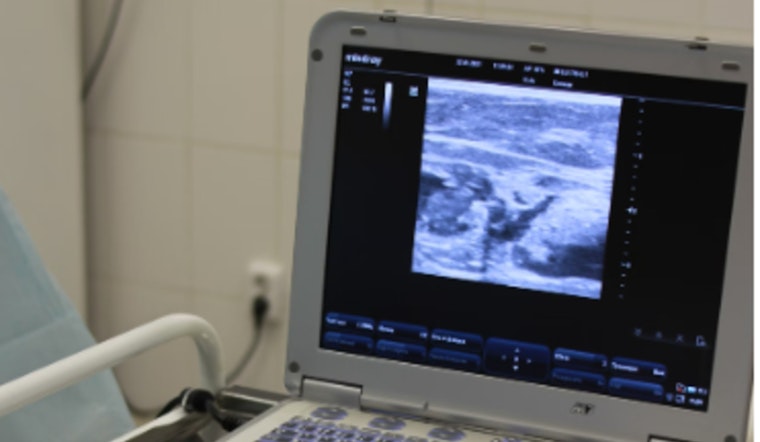 Indiana AG Drops Privacy Suit Against IU Health in Abortion Case Involving Ohio Girl
