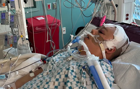 Oakland Father of Two Critically Wounded by Stray Bullet While Asleep, Community Rallies with Fundraiser