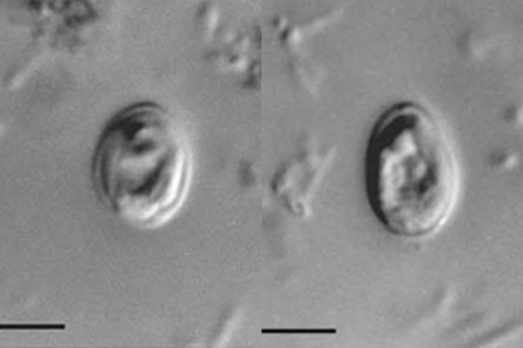 Outbreak of Cryptosporidium Linked to Erlanger Water Park, Northern Kentucky Health Officials Warn