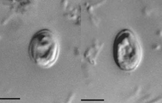 Outbreak of Cryptosporidium Linked to Erlanger Water Park, Northern Kentucky Health Officials Warn