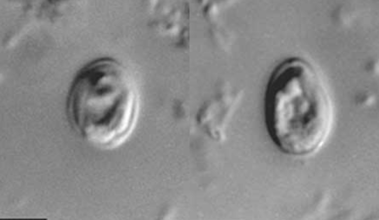 Outbreak of Cryptosporidium Linked to Erlanger Water Park, Northern Kentucky Health Officials Warn