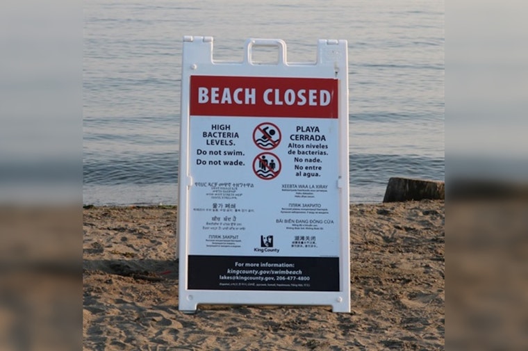 Seattle & King County Health Advisory: Houghton and O.O. Denny Parks Off-Limits for Water Activities Amid Health Concerns