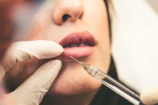 Arizona Woman's Quest for Affordable Lip Fillers Leads to Medical Nightmare