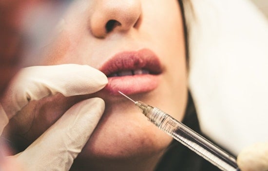 Arizona Woman's Quest for Affordable Lip Fillers Leads to Medical Nightmare