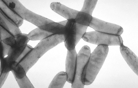 Gaston County Investigates a Cluster of Legionnaires' Disease Cases with Unknown Source