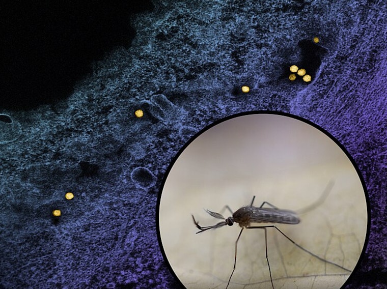 Los Angeles Reports First West Nile Virus-Related Death of the Season