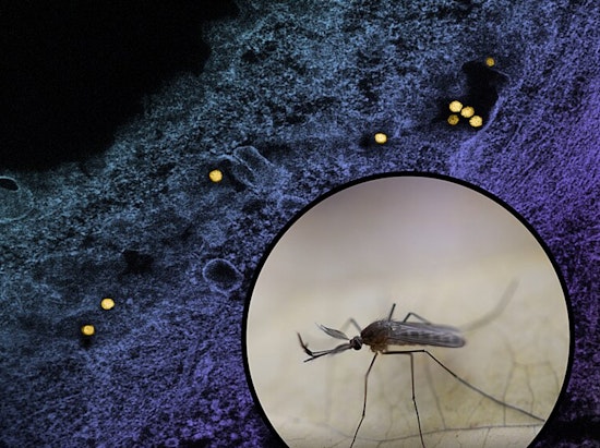 Los Angeles Reports First West Nile Virus-Related Death of the Season