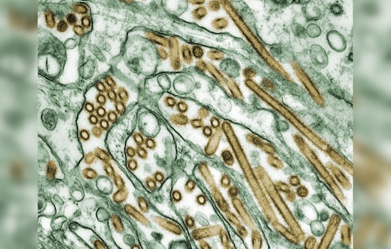 Missouri Confirms First Human Case of H5N1 Avian Flu, St. Louis Authorities Issue Safety Advisory