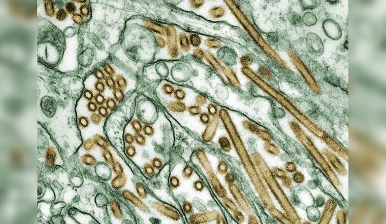 Missouri Confirms First Human Case of H5N1 Avian Flu, St. Louis Authorities Issue Safety Advisory