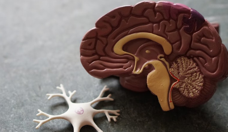MIT Researchers Pioneer Placebo Pain Relief Model Based on Environmental Cues