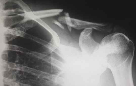 New AI Tool ScribblePrompt Elevates Medical Imaging Efficiency in Boston Collaboration