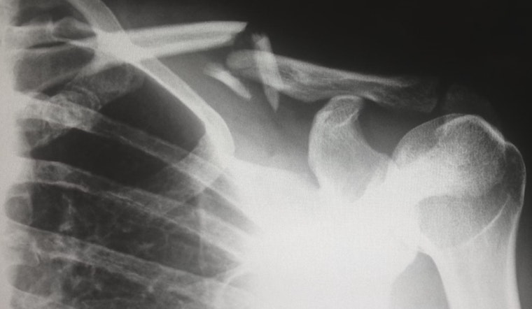 New AI Tool ScribblePrompt Elevates Medical Imaging Efficiency in Boston Collaboration