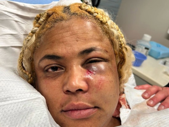 UPDATE: San Francisco DA Charges Man with Hate Crime in Assault on Celebrity Chef Wendy Drew