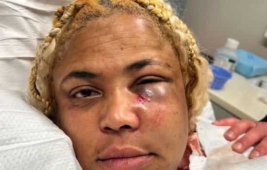 UPDATE: San Francisco DA Charges Man with Hate Crime in Assault on Celebrity Chef Wendy Drew