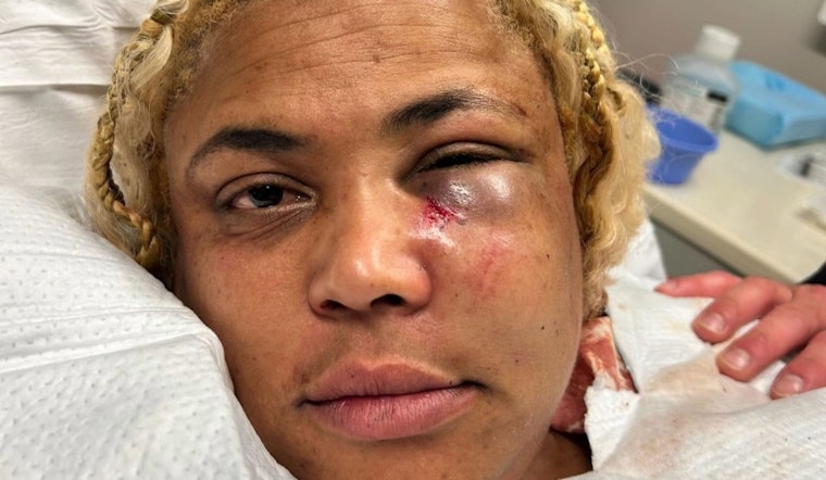 UPDATE: San Francisco DA Charges Man with Hate Crime in Assault on Celebrity Chef Wendy Drew