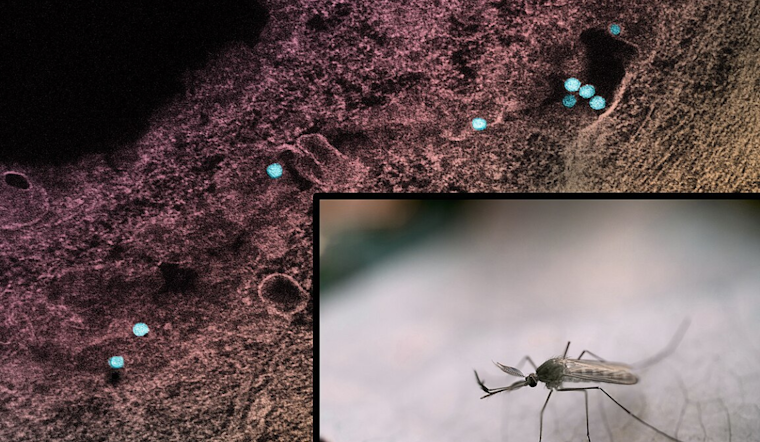 West Nile Virus Cases Rise to Seven in Denton County, Health Officials Urge Precautionary Measures