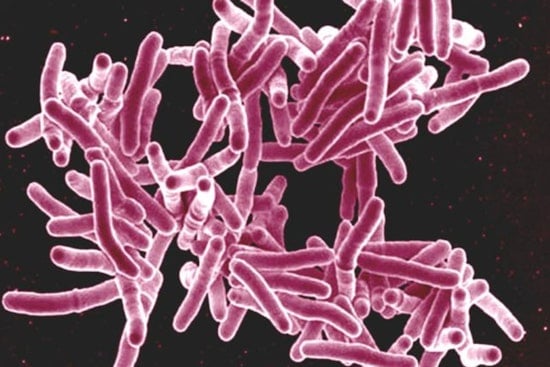 Active Tuberculosis Case Confirmed at Kalamazoo Central High School, Health Officials Respond