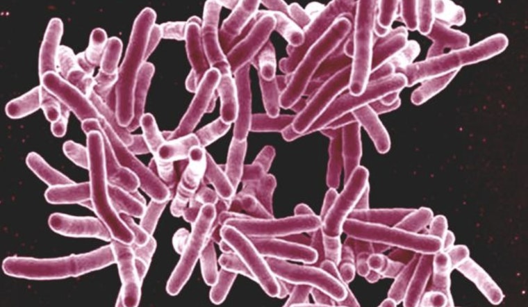 Active Tuberculosis Case Confirmed at Kalamazoo Central High School, Health Officials Respond