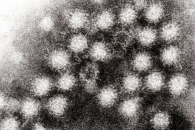 Austin Faces Rising Norovirus Cases Amid National Increase, Local Doctor Confirms