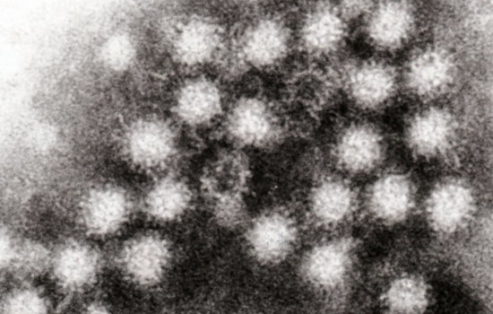 Austin Faces Rising Norovirus Cases Amid National Increase, Local Doctor Confirms